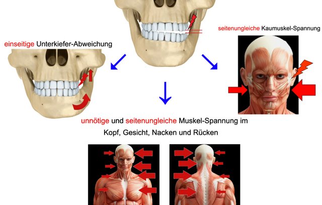 CMD Ursache